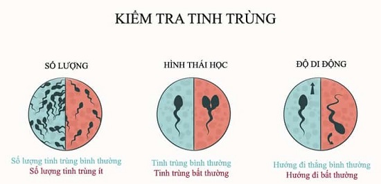 Tinh trùng di động kém